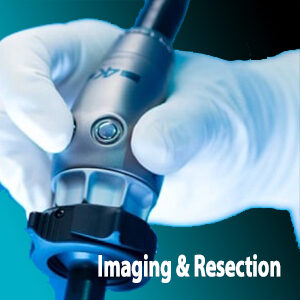 Imaging and Resection - Alon Medical Technology serving Louisiana and Mississippi