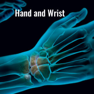 arthrex-hand-wrist